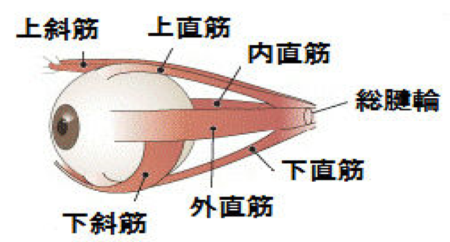眼筋麻痺(複視)