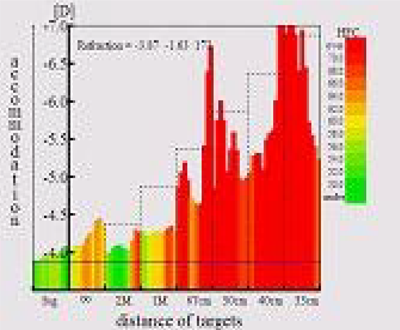 スマホ老眼の人の検査