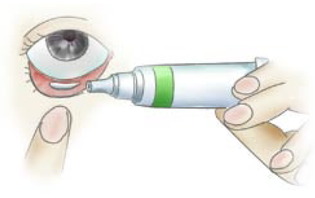 軟膏ってどうやってつけるの？
