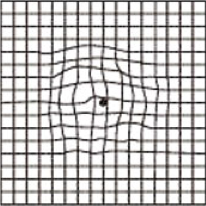 中心がゆがんで見える