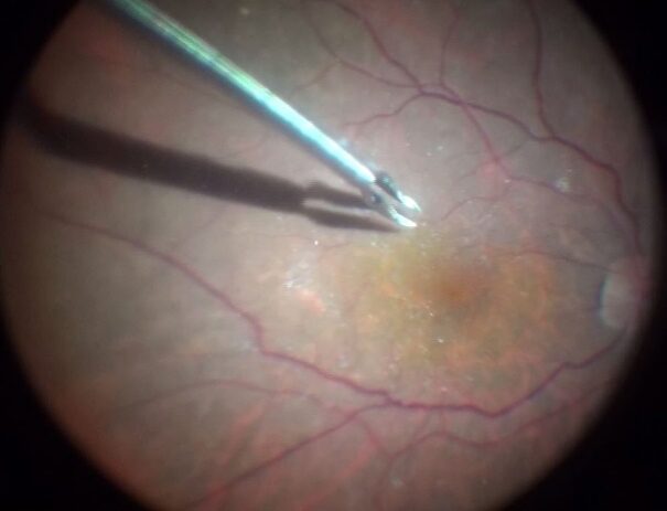 うすい膜を剥がします