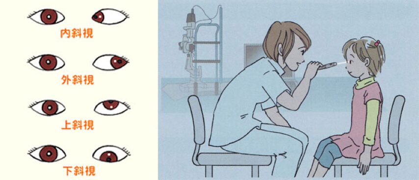 眼科診療クローズアップより