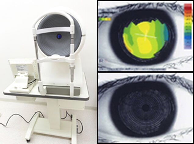 オーダーメイドコンタクトの利点