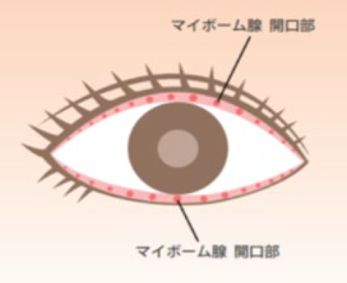 マイボーム腺機能不全