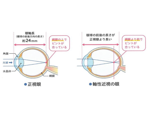 平均的な眼軸長