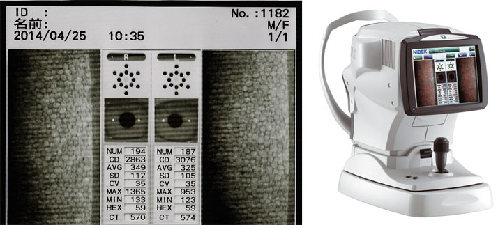 スペキュラーマイクロスコープ（角膜内皮細胞計測）
