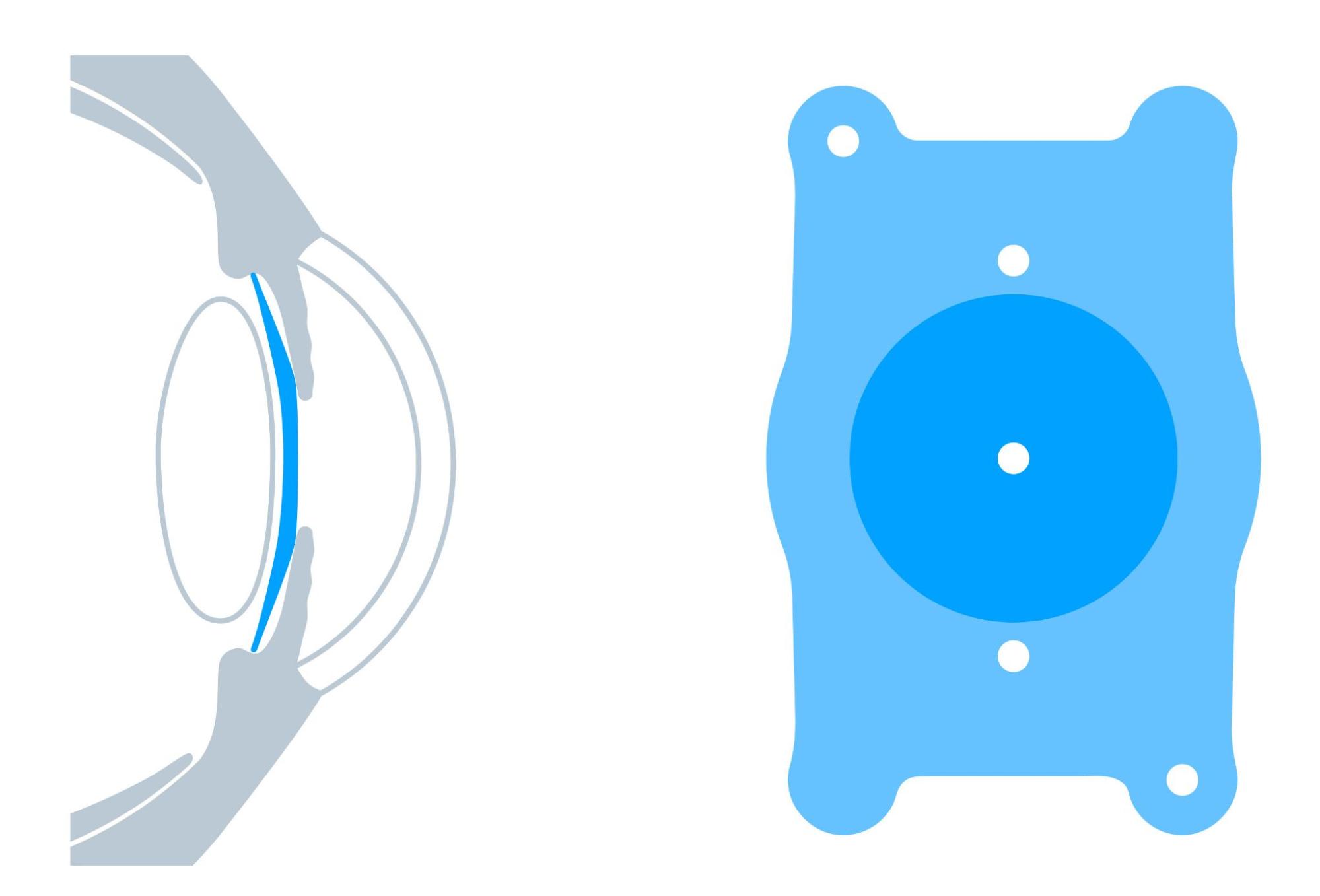 ICL　デメリット