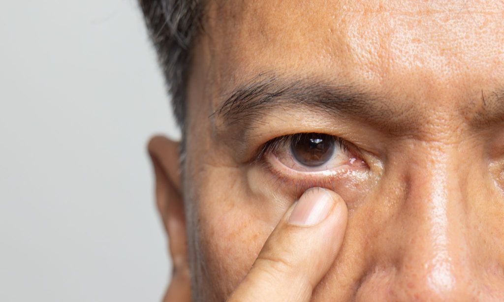 下まぶたを押さえている中年男性